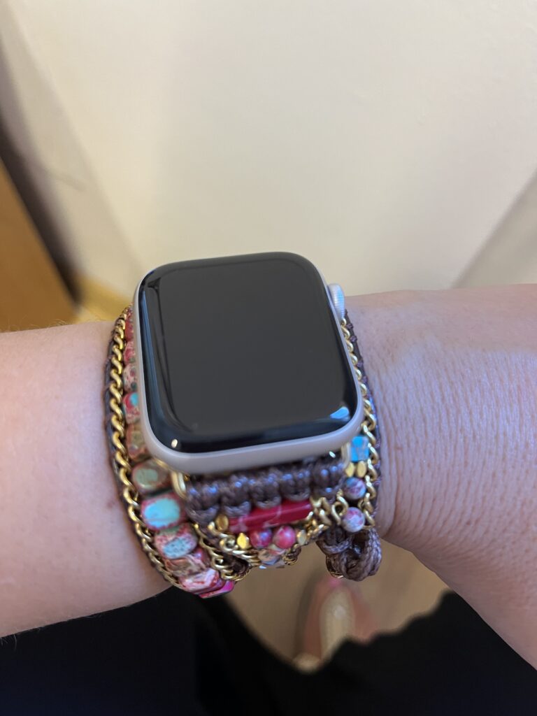 Cherry Dream Pasek do Apple Watch (42-45mm) photo review
